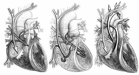 Heart_drawings_3_by_PJK