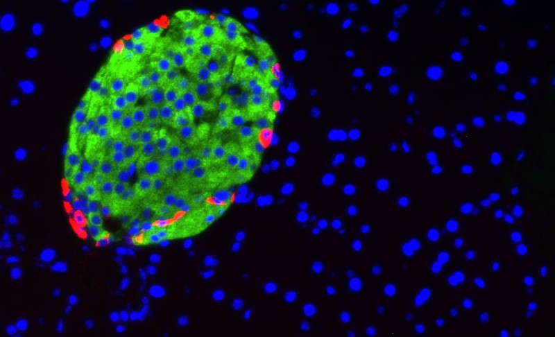 Miniature messenger molecules released by cells in the pancreas (green) may hold the key to early diagnosis of diabetes