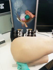 ICCESS prototype haptic simulator for rectal examinations