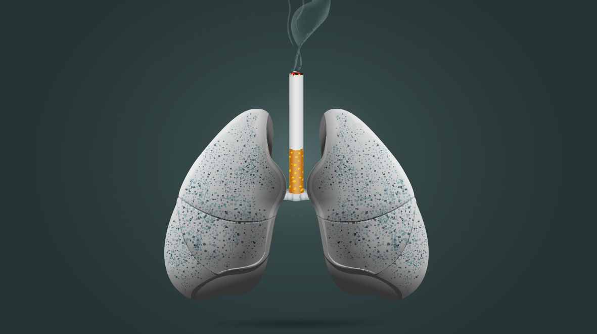 Image: Shutterstock - SMOKE & THE BURNOUT OF MUSCLES