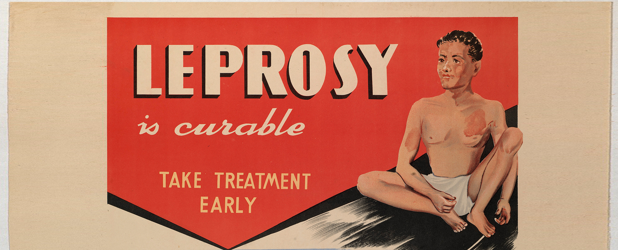 World Leprosy Day. Image courtest of Wellcome Collection.